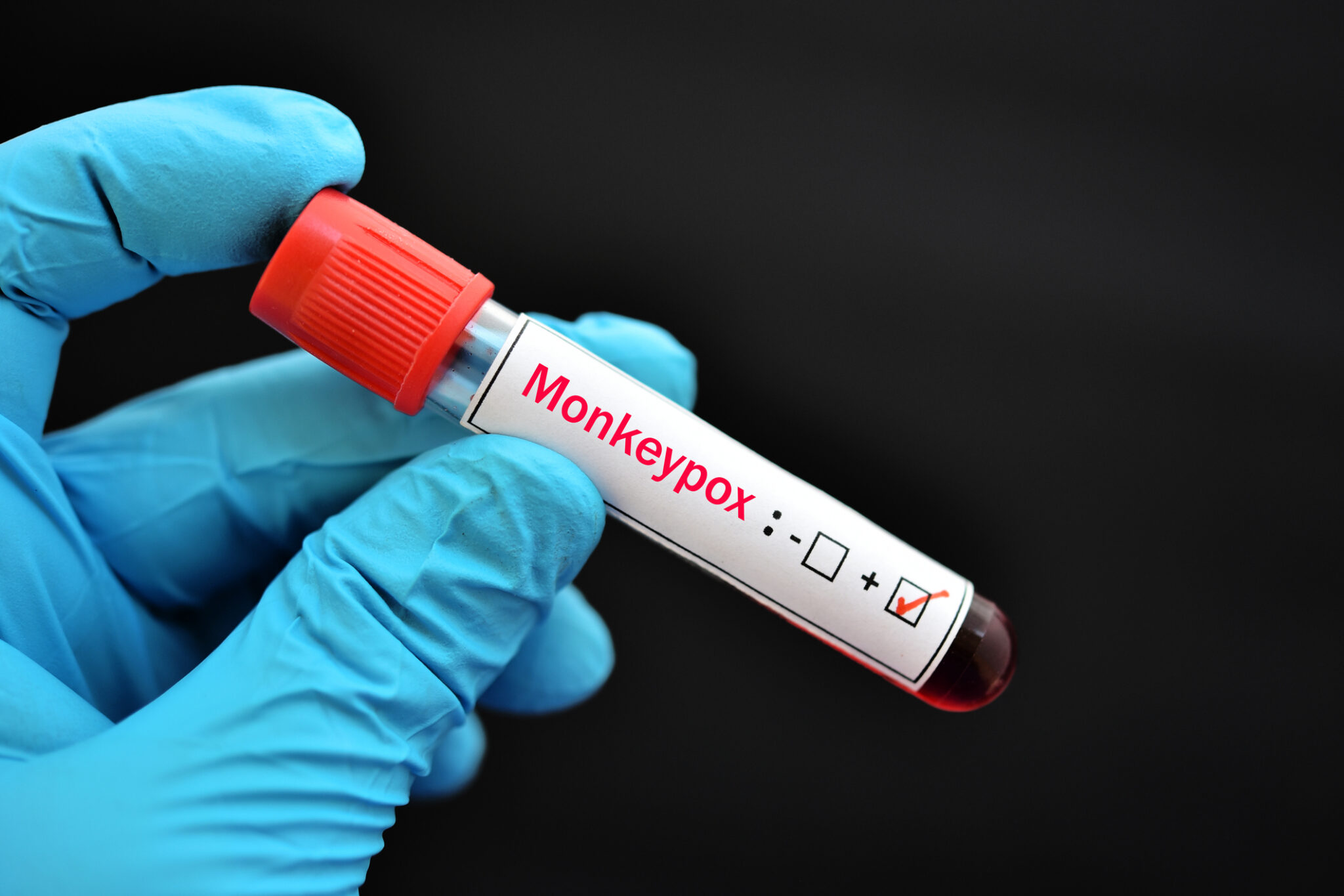 State health officials preach prevention as Monkeypox, COVID-19 continue spread