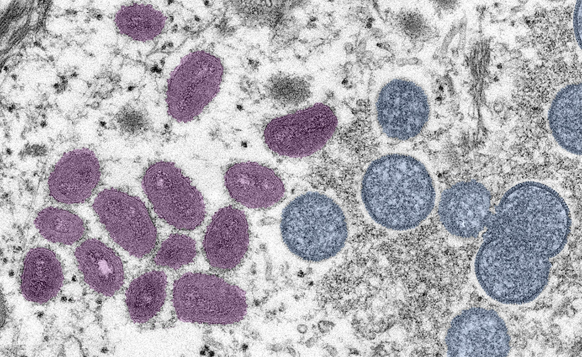 Warren County Health District Monkeypox bulletin