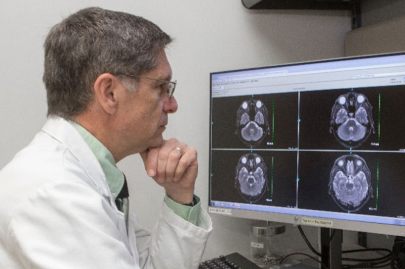 The evolution of poststroke recovery